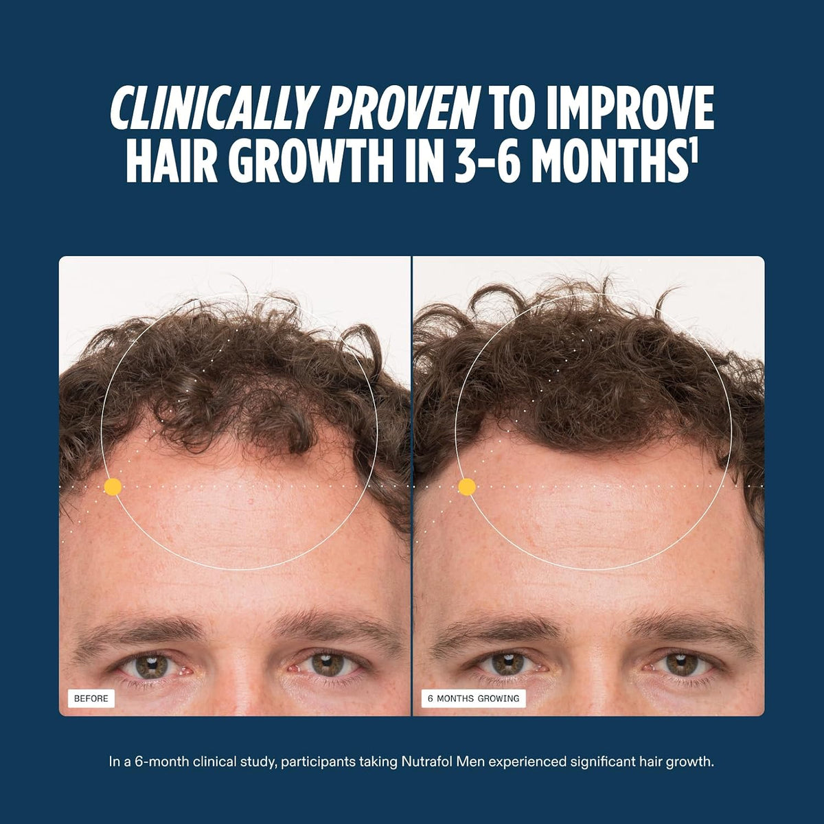 Nutrafol Men Hair Growth Supplements, Ages 18-49, 2-Month Bundle