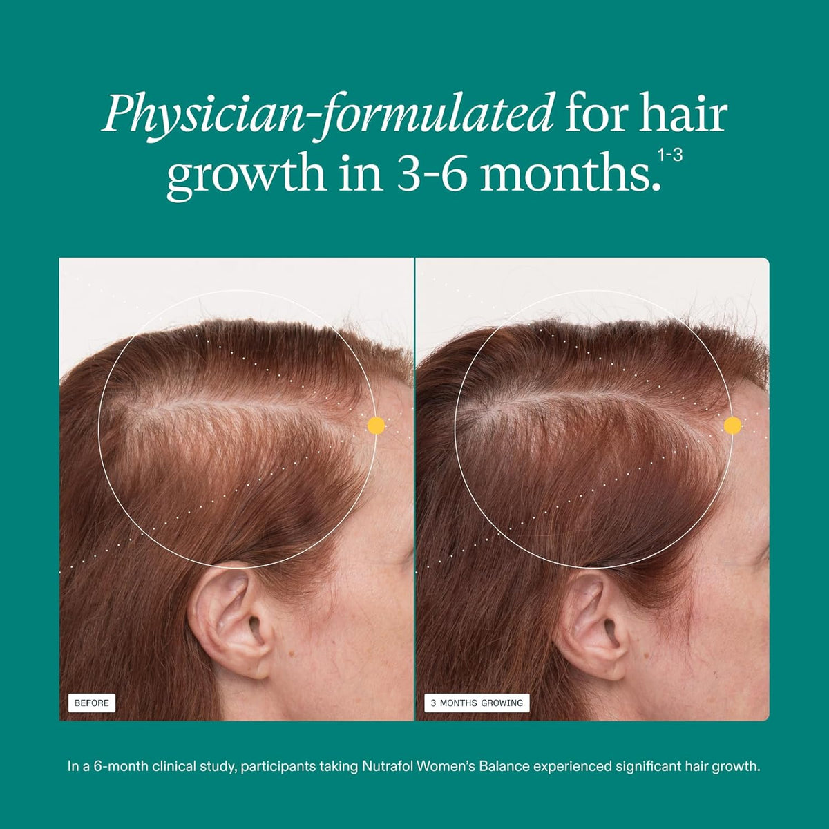 Nutrafol Women's Balance Hair Growth Supplements, Age 45+, 2-Month Bundle