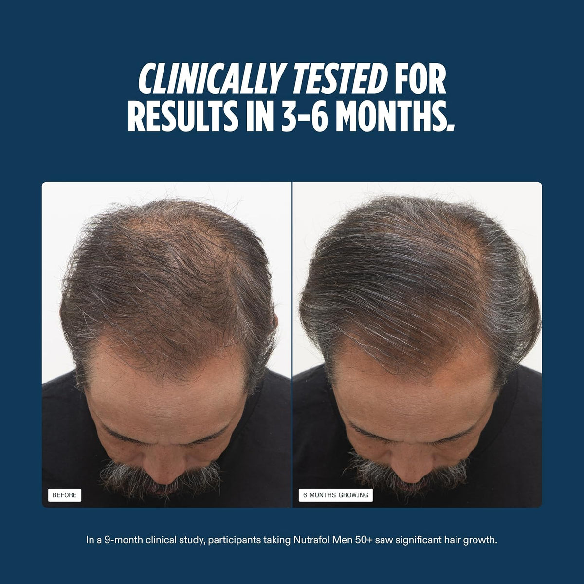Nutrafol Men 50+ Hair Growth Supplements, Age 50+
